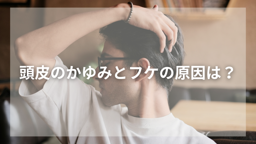 かゆい頭皮とフケに悩む男性