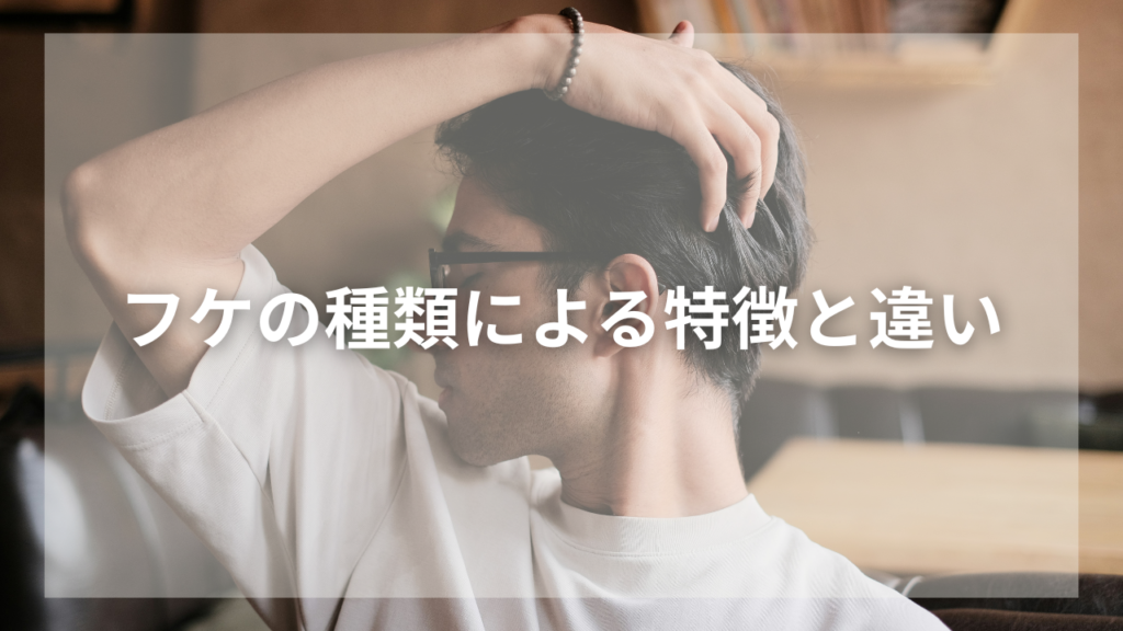 かゆい頭皮とフケに悩む男性
