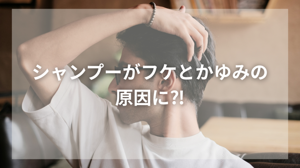 かゆい頭皮とフケに悩む男性
