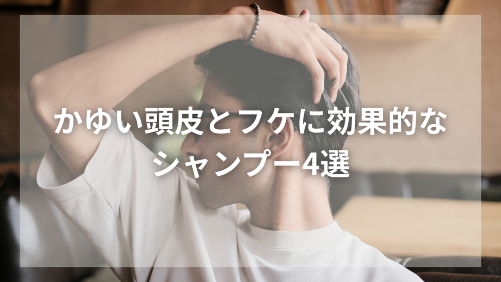 かゆい頭皮とフケに悩む男性